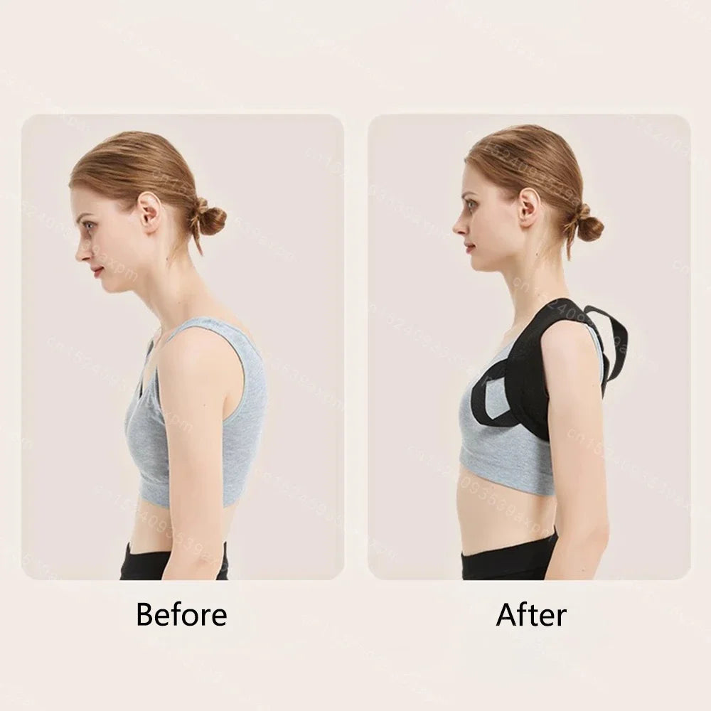 Back Posture Corrector Clavicle Spine Back Brace Belt Adjustable Upper Back Shoulder Lumbar Posture Correction Body Shaping